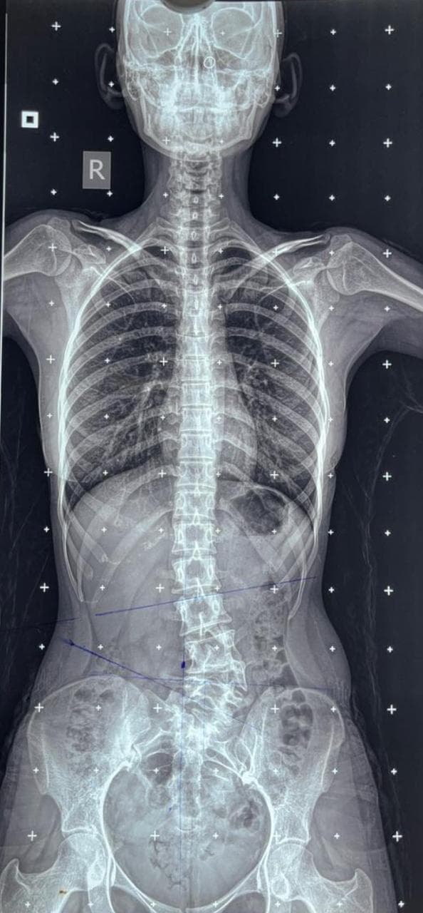 Dr. Bhupendra Pratap Bharti