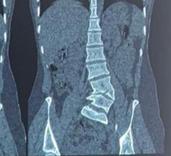 Dr. Bhupendra Pratap Bharti