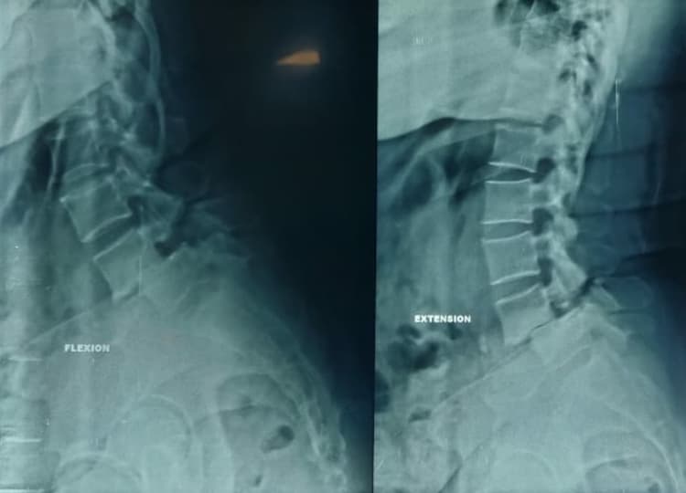 Preoperative Image 1