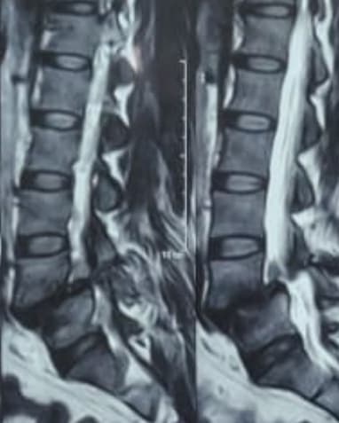 Preoperative Image 2