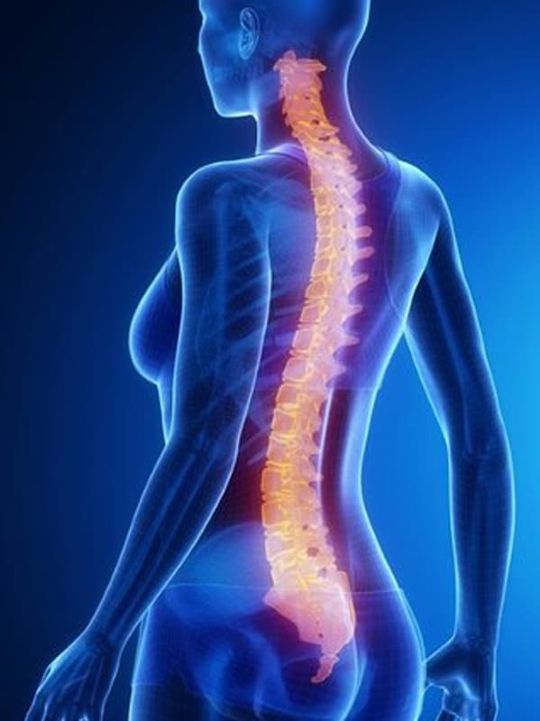 Deformity Correction